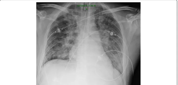 Fig. 1 Chest X- ray made just before pronation (see text for further details)