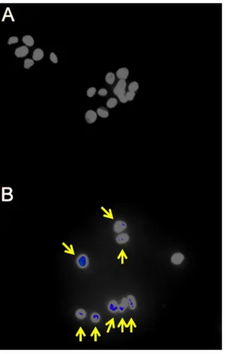 Figure 1 Fluorescence immunohistochemistry for gH2AX foci in g-irradiated HepG2 cells