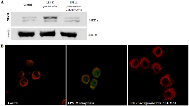 FIGURE 2. NF- ␬B inhibition in macrophages. A, Western blotting showing protein expression in cells stimulated with 25 ng/ml LPS from K