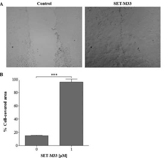 FIGURE 5. Effects of SET-M33 peptide on wound closure in a monolayer of HaCaT cells. A, wounds at 24 h photographed by phase contrast light microscopy in control wells (left panel) and in wells incubated with SET-M33 1 ␮ M (right panel)