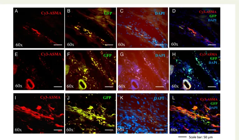 Figure 7 Engraftment and vascular differentiation of AT-MSCs with or without conjugation with PLGA microspheres in the infarcted hearts