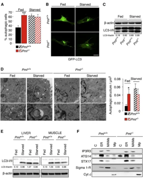 Figure 1. PML Represses Autophagic Pro- Pro-cesses