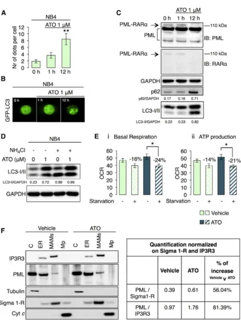 Figure 6. Selective Degradation of the PML- PML-RAR a Oncogenic Fusion Protein in APL Human Cancer Restores a Correct PML Localization and the Sensitivity to Metabolic Stress