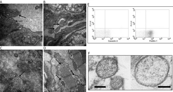 Figure 2. Electron microscopy of heart tissue. (A,B) Budding of the vessel wall to release the exosomes  into  the  lumen  (black  arrows);  (C)  exosomes  in  the  extracellular  space;  (D)  exosomes  released  by  myocyte fiber