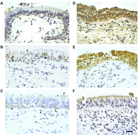 FIG 3. Bronchial epithelial TLR3, MDA5, and RIG-I protein staining is not deficient in asthmatic patients and is increased by rhinovirus infection in vivo