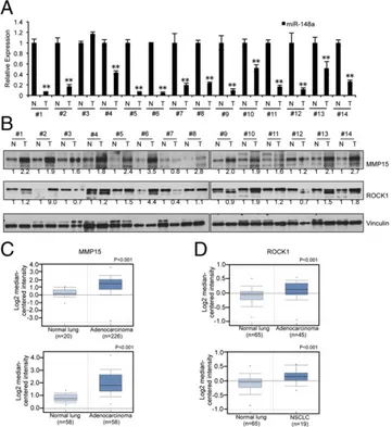 Fig. 6. miR-148a expression is inversely correlated to MMP15 and ROCK1 protein expression in NSCLC tumor sets