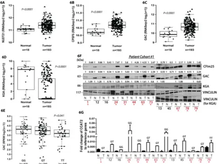 Figure 6. CCAT2, NUDT21 (CFIm25), CPSF6 (CFIm68) and GLS (GAC and KGA) expression  pattern in TCGA dataset and CRC patient samples