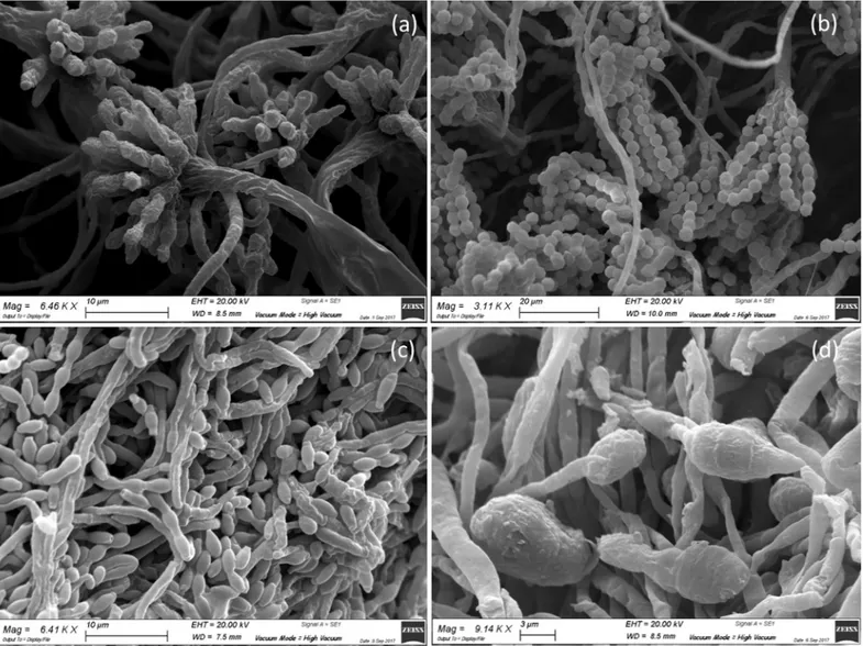 Fig 4. SEM analysis of molds isolated from the recto of the painting. Microphotographs show: a) conidial heads of Aspergillus spp