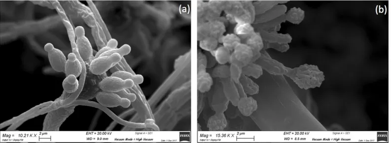 Fig 6. SEM photomicrographs of mycogenic minerals tangled in fungal hyphae. Original magnification a) 8.07 kx and b) 18.28 kx