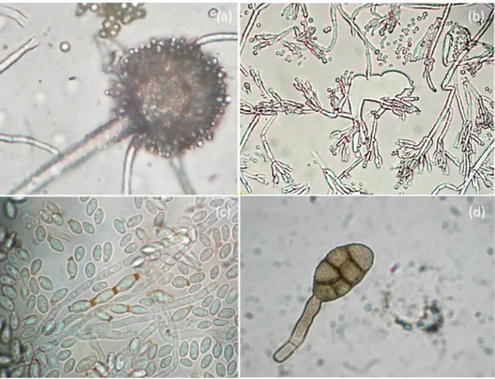 Fig 3. OM analysis of molds isolated from the recto of the painting. Photomicrographs show: a) conidial heads of Aspergillus spp