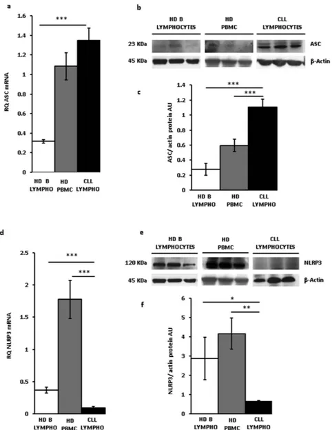 Figure 2.  ASC and NLRP3 expression in CLL lymphocytes. Peripheral CLL lymphocytes and B lymphocytes 