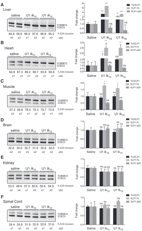 Figure 5. AAV9-mediated delivery of ExSpeU1s Ik10 and Ik15 rescues the hELP1 splicing defect in FD mouse model
