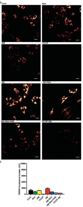 Figure 4. Aβ does not trigger mitochondrial hyperpolarization in N13R microglia. Microglia cells were 