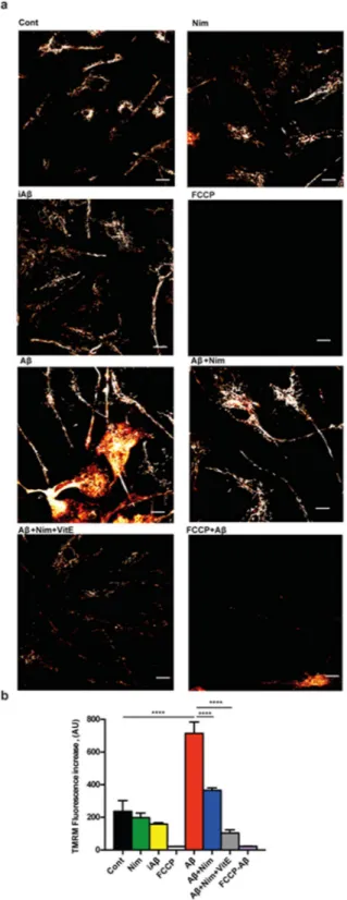 Figure 5. Aβ drives mitochondrial hyperpolarization in primary wt microglia: inhibition by nimodipine