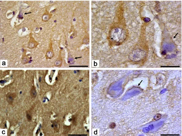 Fig. 3. Immunohistochemical localization of the NADPH oxidase subunits in epileptic sclerotic hippocampus