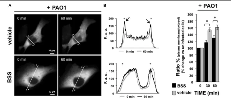 FIGURE 7 | Effect of BSS on PKC α translocation. IB3-1 cells were seeded and then transfected with the Protein Kinase C isoform α fused to green fluorescence protein (PKC αGFP)