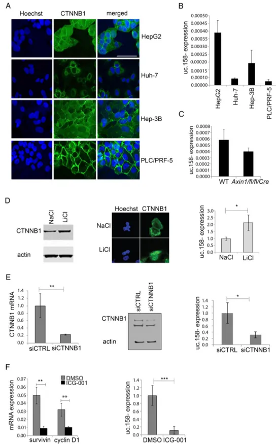 Figure 2 uc.158 − expression is dependent on Wnt/ β-catenin pathway in human malignant hepatocytes