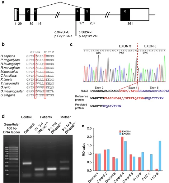 Fig. 2 Genetic ﬁndings associated with bilallelic mutations in DNASE2. a Intron/exon structure of the DNASE2 gene, with the splicing-out of exon 4 consequent upon the c.347G &gt;C mutation indicated by the lines above the ﬁgure
