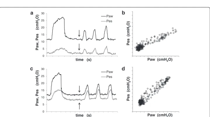 Fig. 2 Validation test at different esophageal catheter-filling volumes. Panels (a) and (c): Paw and Pes over time, during a single mechanical respiratory breath and an end-expiratory occlusion maneuver with chest compressions