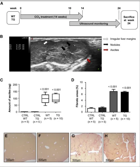 Figure 1. Carbon Tetrachloride Treatment Induces Cirrhosis in Wild-Type and TG221 Mice