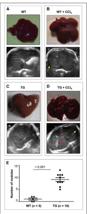 Figure 2. CCl4 Treatment Promotes Cirrhosis and Tumor Formation in the Livers of TG221 Mice