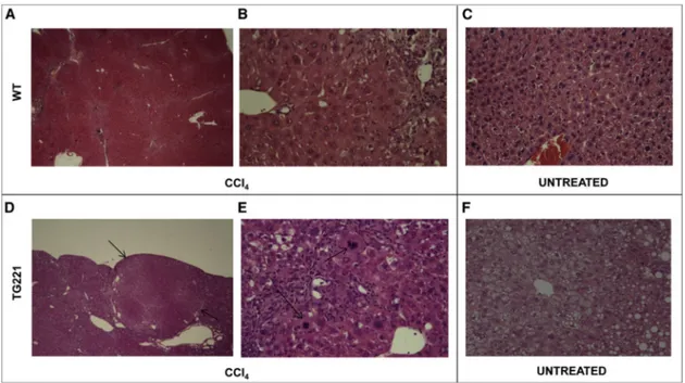 Figure 3. CCl4-Treated TG221 Mice Present Neoplastic Proliferative Lesions