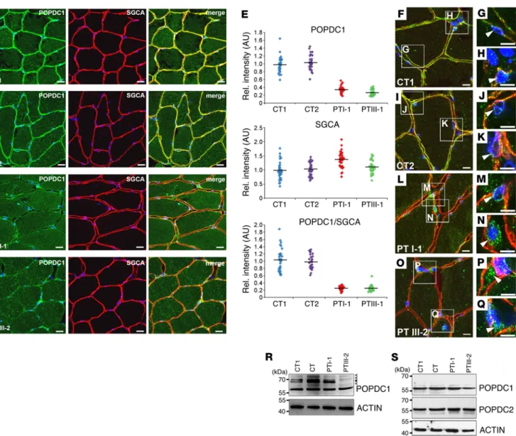 Figure 2. Membrane trafficking of POPDC1 is affected in muscle biopsies. Skeletal muscle biopsies of PTI-1 and PTIII-1 and 2 controls were immunos-