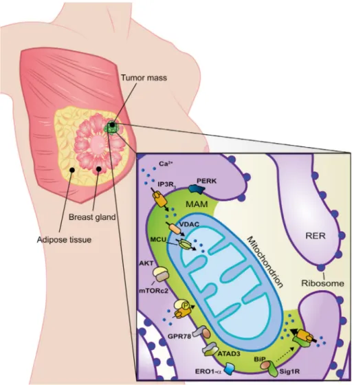 Figure 2. MAM alterations in breast cancer. MAM-resident proteins (green zone) strictly involved in breast cancer onset, progression, and metastasis are shown in the figure