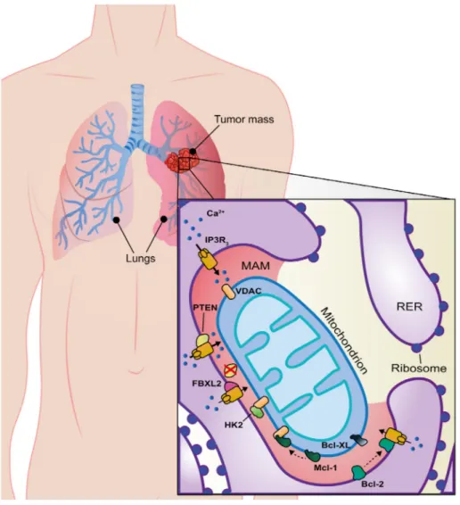 Figure 3. MAM alterations in lung cancer. MAM-resident proteins (red zone) strictly involved in lung cancer onset, progression, and metastasis are shown in the figure