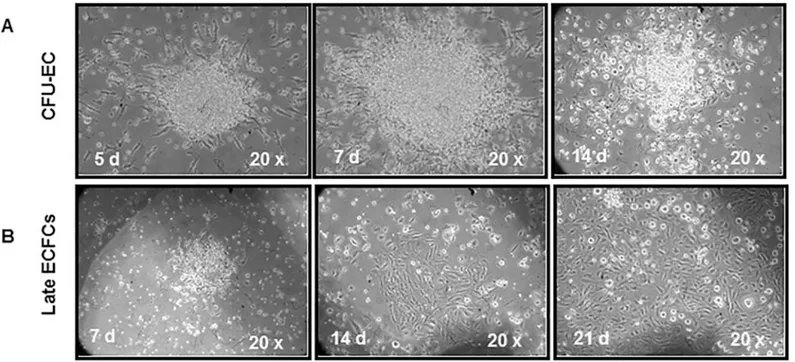 Fig 2. Colony forming units-endothelial cells and late endothelial colony forming cells