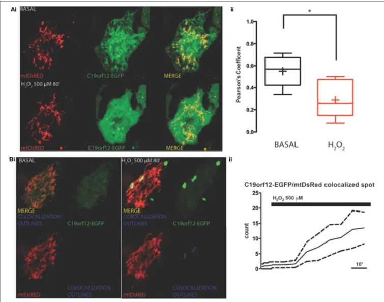 FIGURE 3 | Redistribution of C19orf12 during oxidative stress. (Ai) Representative images of HeLa cells overexpressing the C19orf12-EGFP fusion protein and the mitochondrial marker mtDsRED before (upper panel), and after (lower panel) exposure to H 2 O 2 5