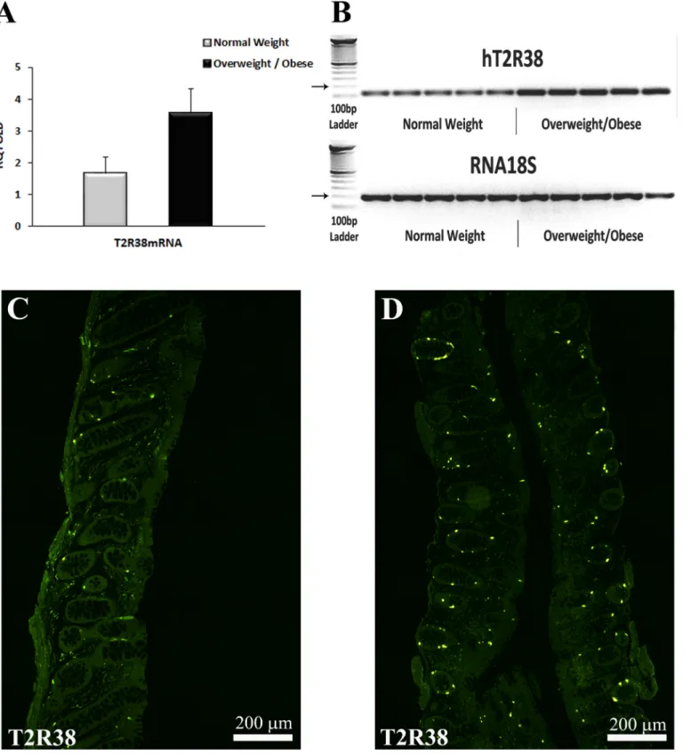 Fig 1. T2R38 mRNA levels and T2R38-IR cell in colonic mucosal biopsies of NW and OW/OB subjects