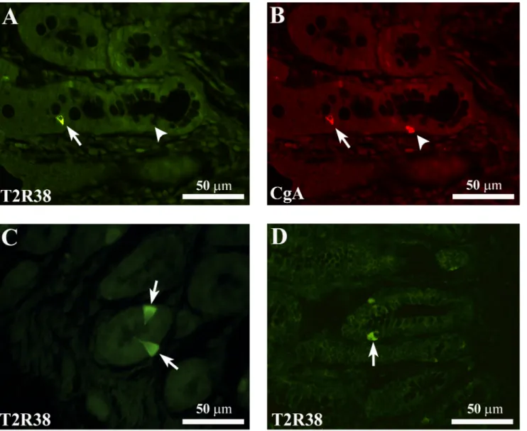 Fig 3. Representative confocal images of T2R38- and CgA-IR cells. (A) Shows a T2R38-IR cell (arrow) which is immunoreactive for chromogranin A (CgA)-IR (B, arrow) in the colonic mucosa of a NW subject