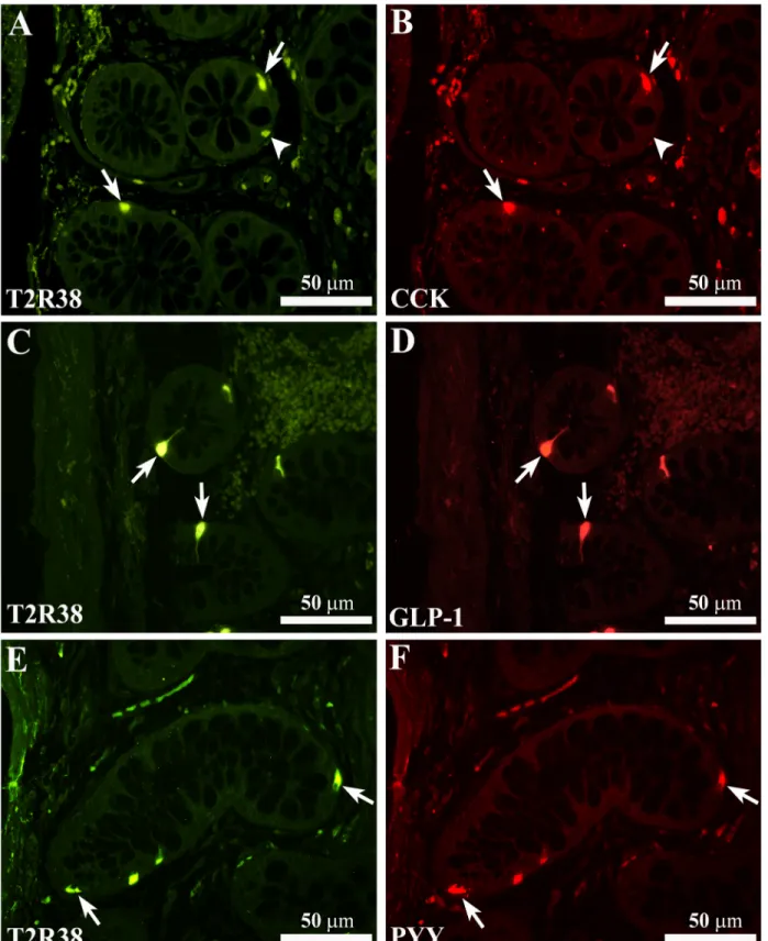 Fig 4. Colocalization of T2R38-IR with CCK-, GLP-1- or PYY-IR immunoreactivity. Confocal images showing T2R38-IR cells (A, C and E, arrows) containing immunoreactivity for CCK (B), GLP-1 (D) or PYY (F)