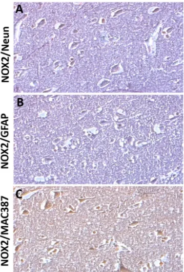 Figure 2.  NOX2 increase in cortical neurons and microglia of subjects died following TBI