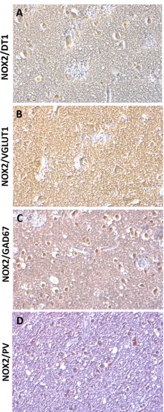 Figure 3.  NOX2 increase in cortical GABAergic PV-positive interneurons. (A–D) Representative contrast 