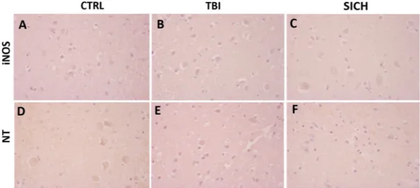 Figure 4.  The nitrergic system is not affected by TBI. (A–C) Representative images of iNOS immunostaining 