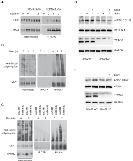 Fig. 5. TRIM32 is required for ULK1 activation through K63-linked polyubiquitin upon dexamethasone treatment