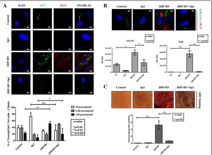 Fig. 9 Spautin-1 prevents the autophagy-associated osteoblastic differentiation of Human Gingival Mesenchymal Stem cells