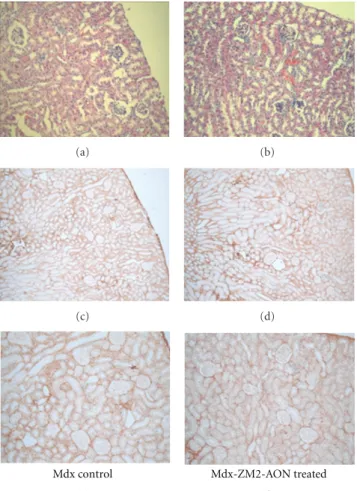 Figure 3: Dystrophin-positive fibre counting. Dystrophin-positive fibre counting was performed on fibres with a labelling that covers at least 80% of the sarcolemma perimeter