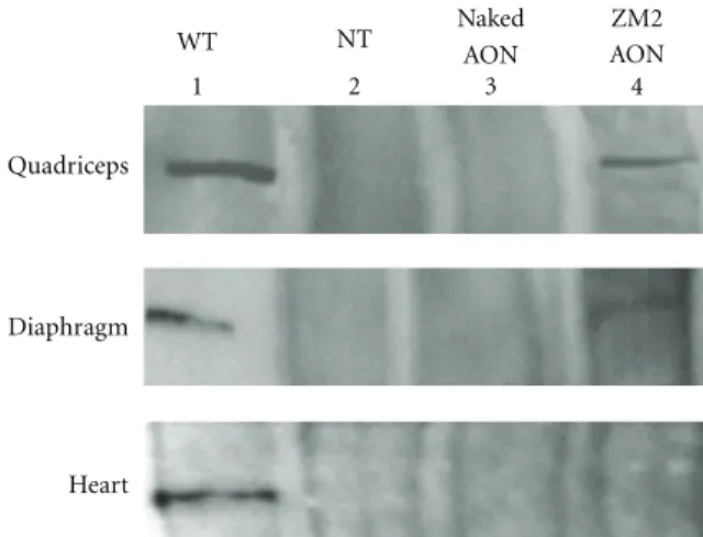 Figure 5: Western blot analysis. Immunoblotting for dystrophin using DYS2 antibody showed restored expression of the protein in the quadriceps and diaphragm of ZM2–AON-treated mice (lane 4), while no protein was detected in either untreated control (NT, la