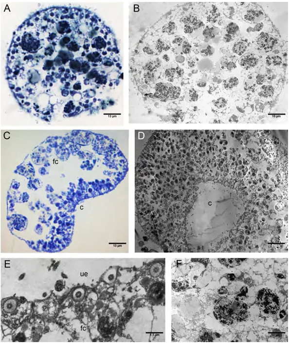 Figure 7 Fine morphology of P+EtOH Placozoa. Frontal semithin (A) and thin (B) section showing the