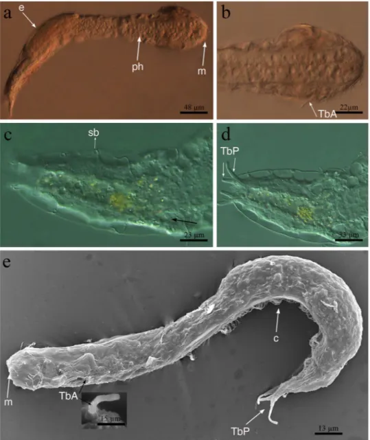 Figure 2.  Redudasys brasiliensis sp. nov. Optical DIC micrographs. (a) Habitus. (b) Anterior body end