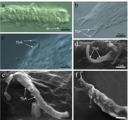 Figure 5.  Redudasys fornerise. Optical DIC micrographs. (a) Body anterior region. (b) Posterior and caudal 