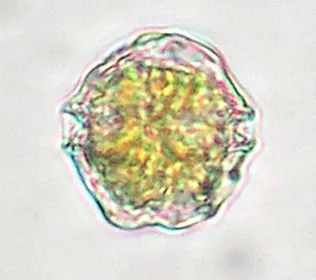 Fig. 4: The dinoflagellate Alexandrium minutum  PSP producing species. 