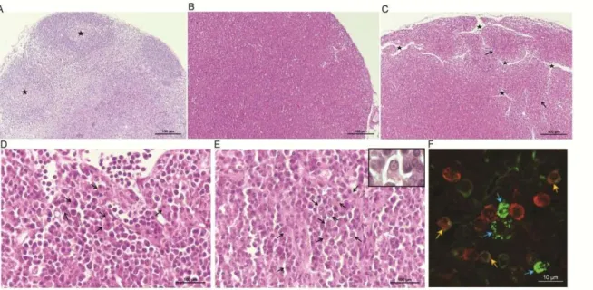 Figure 8. Hematoxylin and eosin (H&amp;E) staining of sections of lymph nodes of uninfected, infected/untreated  (I) and infected/treated (I+I-152) mice (A-E) and immunofluorescence staining of section of lymph nodes of  infected mice (F)