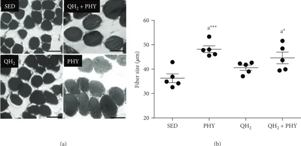 Figure 4: (a) Representative microphotographs of ﬁbers (SED, bar = 25 μm; PHY, bar = 65 μm; QH 2 , bar = 35 μm; and QH 2 + PHY, ba