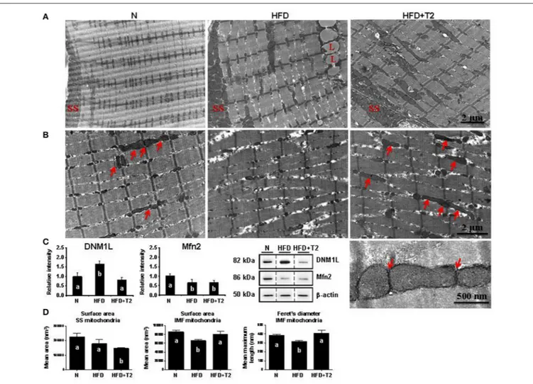 FIGURE 6 | Effects of HFD and T2-treatment on mitochondrial morphology and dynamic markers in gastrocnemius muscle of N, HFD, and HFD+T2 rats
