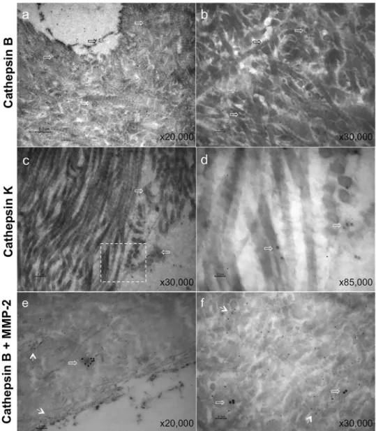 Fig. 2. TEM micrographs of demineralized dentin after a post-embedding immunolabeling procedure