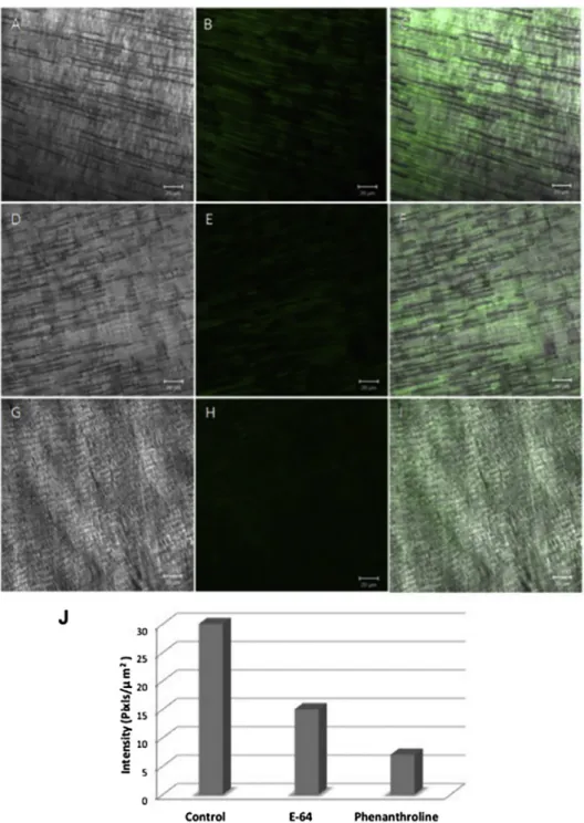 Fig. 3. Dentin slices pre-incubated without inhibitors (control) or with E-64 and 1,10-phenanthroline and incubated for 24 h with quenched ﬂuorescein-labeled gelatin; (A,D, G): Differential interference contrast (DIC), showing the optical density of the de